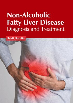 Heidi Hamlin - Non-Alcoholic Fatty Liver Disease: Diagnosis and Treatment, Inbunden. Tillgänglighet: Lägg i varukorg