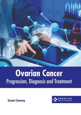 Susan Conway - Ovarian Cancer: Progression, Diagnosis and Treatment, Inbunden