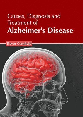 Trevor Cornfield - Causes, Diagnosis and Treatment of Alzheimer's Disease, Inbunden. Tillgänglighet: Lägg i varukorg