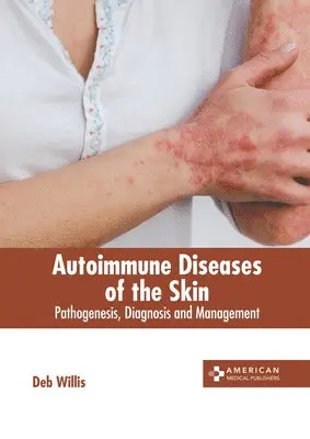 Deb Willis - Autoimmune Diseases of the Skin: Pathogenesis, Diagnosis and Management, Inbunden. Tillgänglighet: Lägg i varukorg