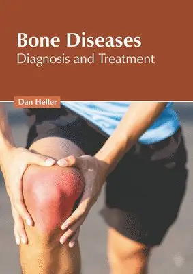 Dan Heller - Bone Diseases: Diagnosis and Treatment, Inbunden. Tillgänglighet: Lägg i varukorg