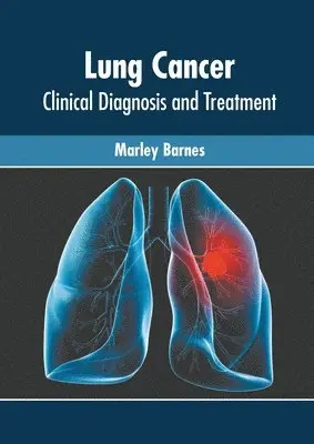 Marley Barnes - Lung Cancer: Clinical Diagnosis and Treatment, Inbunden. Tillgänglighet: Lägg i varukorg
