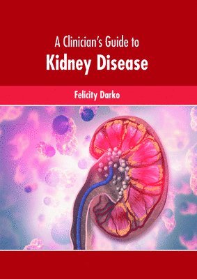 Felicity Darko - A Clinician's Guide to Kidney Disease, Inbunden. Tillgänglighet: Kommande