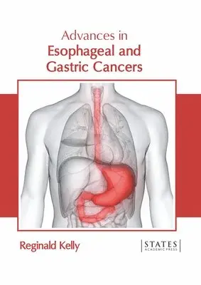 Reginald Kelly - Advances in Esophageal and Gastric Cancers, Inbunden. Tillgänglighet: Lägg i varukorg