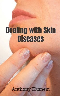 Anthony Ekanem - Dealing with Skin Diseases, Häftad. Tillgänglighet: Lägg i varukorg