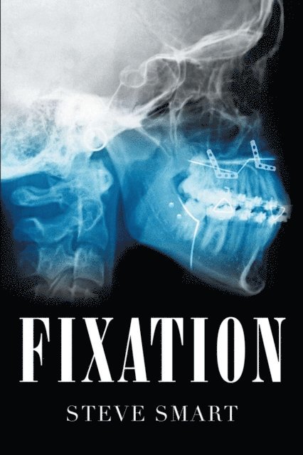 Steve Smart - Fixation, E-bok