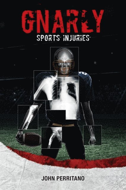 John Perritano John - Gnarly Sports Injuries, E-bok. Tillgänglighet: Lägg i varukorg