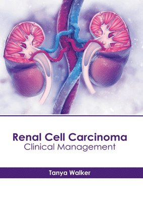 Tanya Walker - Renal Cell Carcinoma: Clinical Management, Inbunden. Tillgänglighet: Lägg i varukorg