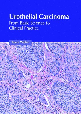 Tanya Walker - Urothelial Carcinoma: From Basic Science to Clinical Practice, Inbunden. Tillgänglighet: Kommande