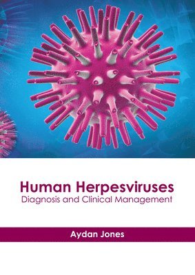 Aydan Jones - Human Herpesviruses: Diagnosis and Clinical Management, Inbunden