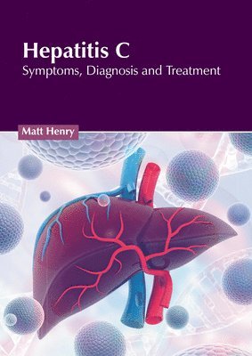 Matt Henry - Hepatitis C: Symptoms, Diagnosis and Treatment, Inbunden