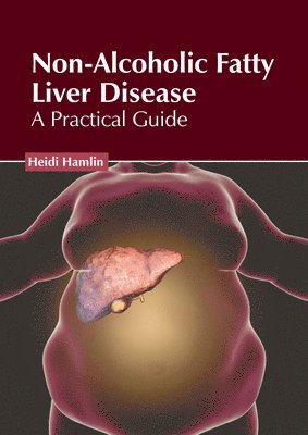 Heidi Hamlin - Non-Alcoholic Fatty Liver Disease: A Practical Guide, Inbunden. Tillgänglighet: Lägg i varukorg