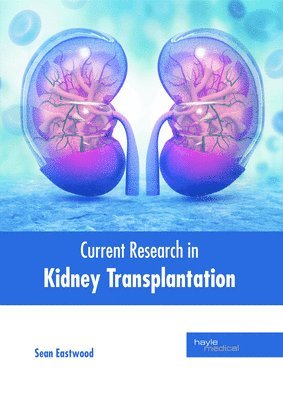 Sean Eastwood - Current Research in Kidney Transplantation, Inbunden. Tillgänglighet: Kommande