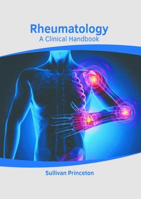 Sullivan Princeton - Rheumatology: A Clinical Handbook, Inbunden. Tillgänglighet: Kommande