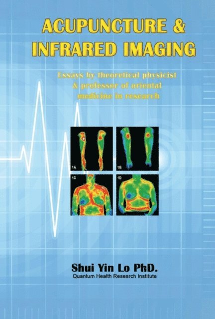 Shui Yin Lo - Acupuncture and Infrared Imaging, E-bok