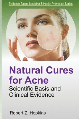 Robert Z. Hopkins - Natural Cures for Acne: Scientific Basis and Clinical Evidence, Häftad. Tillgänglighet: Lägg i varukorg