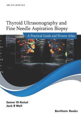 Jack R. Wall, Samer El-Kaissi - Thyroid Ultrasonography and Fine Needle Aspiration Biopsy: A Practical Guide and Picture Atlas, Häftad