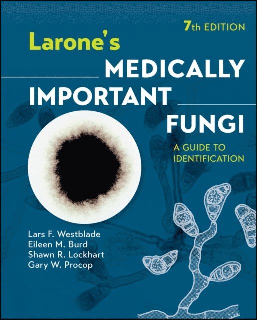 Gary W. Procop, Shawn R. Lockhart, Eileen M. Burd, Lars F. Westblade - Larone's Medically Important Fungi, E-bok