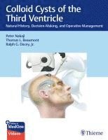 Colloid Cysts of the Third Ventricle