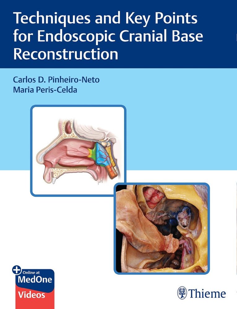 Carlos Pinheiro-Neto, Maria Peris-Celda - Techniques and Key Points for Endoscopic Cranial Base Reconstruction, Övrigt