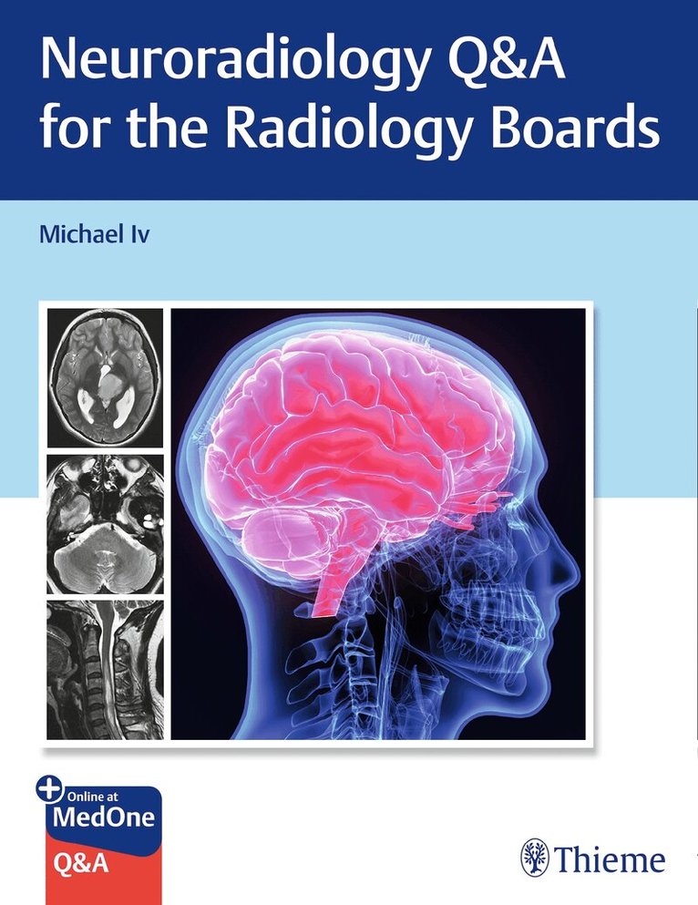 Michael Iv - Neuroradiology Q&a for the Radiology Boards, Häftad