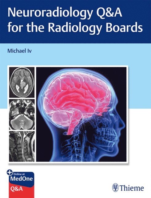 Michael Iv - Neuroradiology Q&A for the Radiology Boards, E-bok
