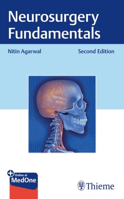 Nitin Agarwal - Neurosurgery Fundamentals, E-bok