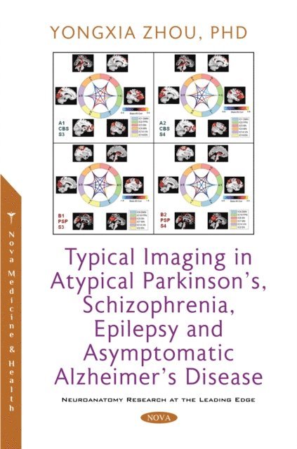 Yongxia Zhou - Typical Imaging in Atypical Parkinson's, Schizophrenia, Epilepsy and Asymptomatic Alzheimer's Disease, E-bok. Tillgänglighet: Lägg i varukorg
