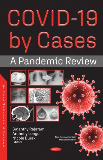 Sujanthy Rajaram - COVID-19 by Cases: A Pandemic Review, E-bok