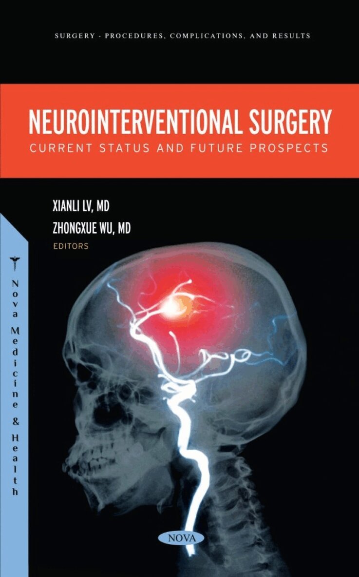 Xianli Lv - Neurointerventional Surgery: Current Status and Future Prospects, Inbunden