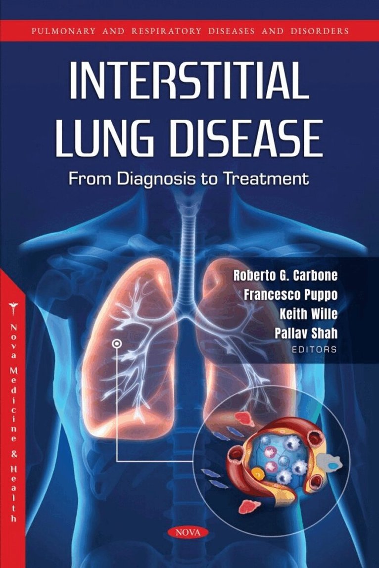 Roberto G. Carbone - Interstitial Lung Disease: From Diagnosis to Treatment, Inbunden