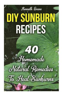 Kenneth Evans - DIY Sunburn Recipes: 40 Homemade Natural Remedies To Heal Sunburns, Häftad