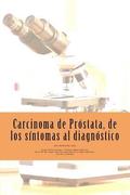 Carcinoma de Próstata, de los síntomas al diagnóstico.