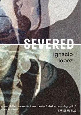 Ignacio Lopez - Severed, Häftad. Tillgänglighet: Lägg i varukorg