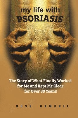 Ross Gambril - my life with PSORIASIS, Häftad. Tillgänglighet: Lägg i varukorg