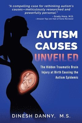Autism Causes Unveiled
