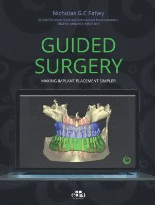Nicholas G.C. Fahey - Guided Surgery, Inbunden. Tillgänglighet: Lägg i varukorg