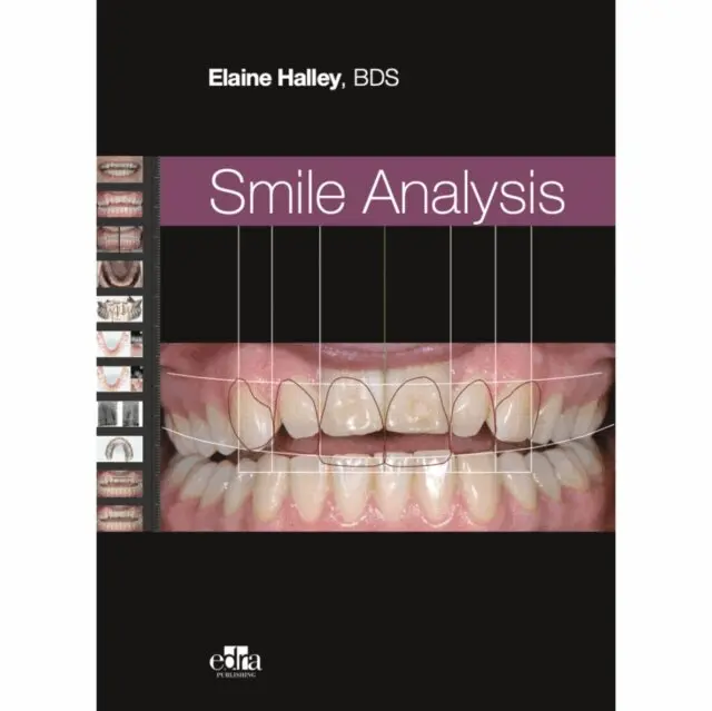 Elaine Halley - Smile Analysis, E-bok. Tillgänglighet: Lägg i varukorg