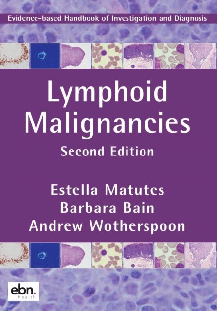 Andrew Wotherspoon, Barbara Bain, Estella Matutes - Lymphoid Malignancies, E-bok