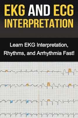 Alyssa Stone - EKG and ECG Interpretation, Häftad. Tillgänglighet: Lägg i varukorg