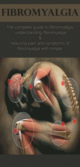 David Anthony - Fibromyalgia, E-bok