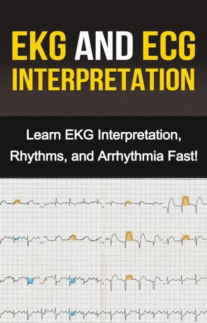 Alyssa Stone - EKG and ECG Interpretation, E-bok. Tillgänglighet: Lägg i varukorg