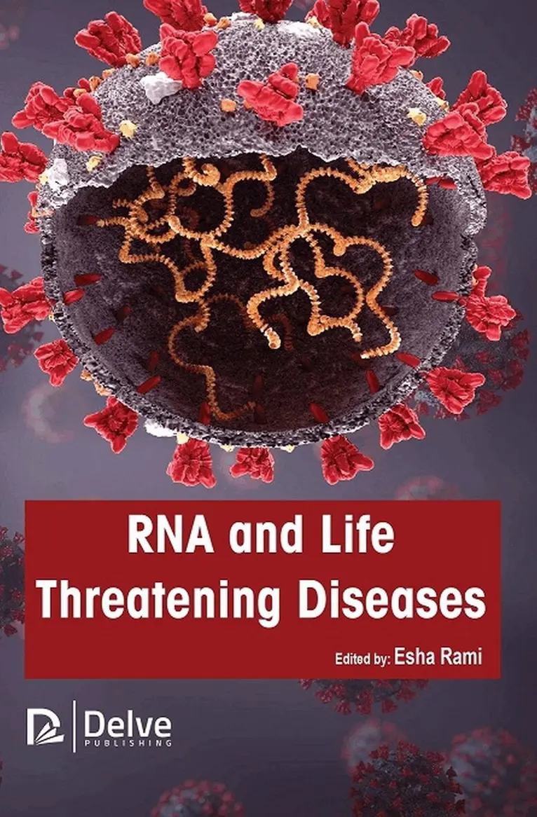 Esha Rami - RNA and Life Threatening Diseases, Inbunden. Tillgänglighet: Tillfälligt slut