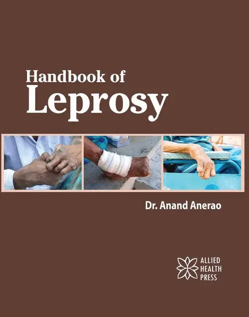 Anand Anerao - Handbook of Leprosy, Inbunden. Tillgänglighet: Lägg i varukorg