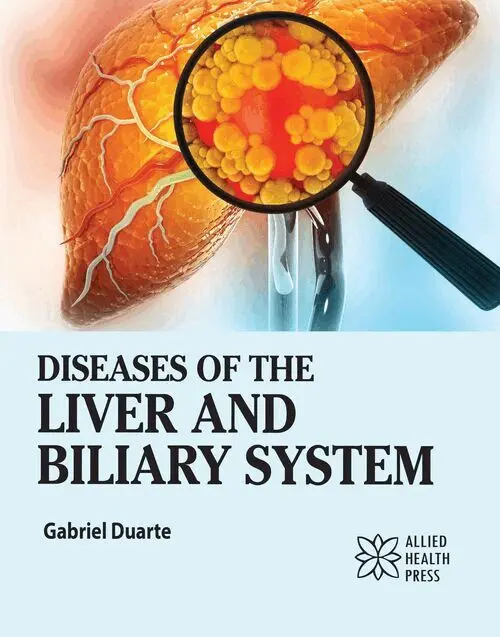 Gabriel Duarte - Diseases of the Liver and Biliary System, Inbunden. Tillgänglighet: Lägg i varukorg