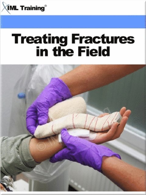 IML Training - Treating Fractures in the Field (Injuries and Emergenices), E-bok. Tillgänglighet: Lägg i varukorg