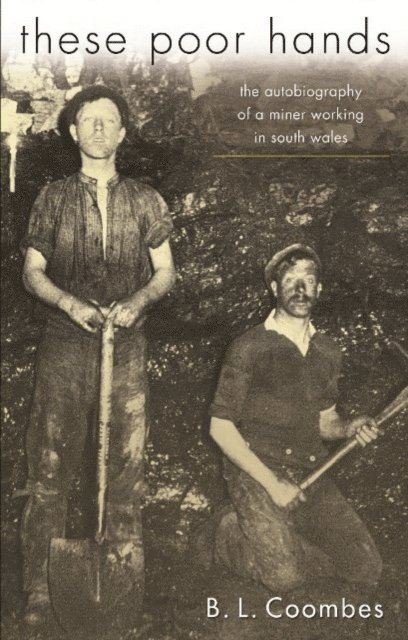 Chris Williams, Bill Jones - These Poor Hands, E-bok