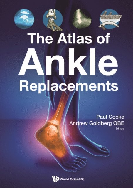 Cooke Paul H Cooke, Goldberg Obe Andrew J Goldberg Obe - Atlas Of Ankle Replacements, The, E-bok