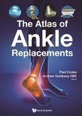Atlas Of Ankle Replacements, The