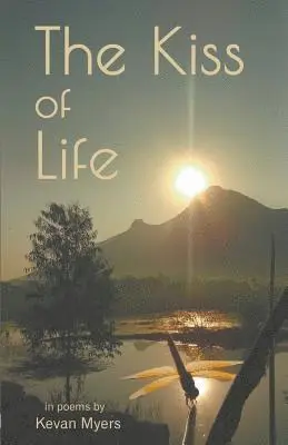 Kevan Myers - Kiss Of Life, Häftad. Tillgänglighet: Lägg i varukorg